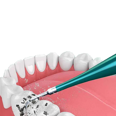 Dental Scaler